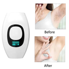 IPL Hair Remover