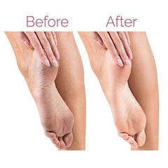 Professional Electric Foot File – Rechargeable Callus Remover for Soft & Smooth Feet